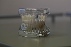 Toda la información sobre Prótesis Dentales