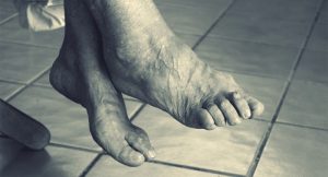 foto de Por qué se hinchan los pies en la tercera edad — y qué puedes hacer desde hoy